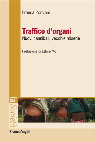 Traffico d'organi.