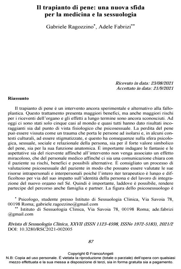 Anteprima articolo